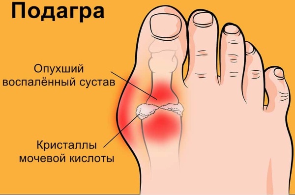 Суворовские термальные источники. Комплекс, показания и противопоказания, цены