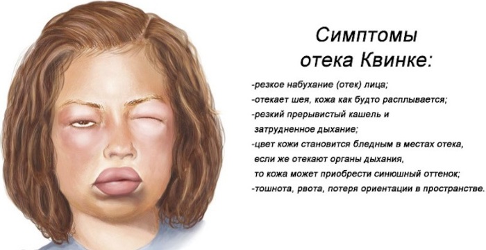 Список лекарств на море с ребенком за границу. Аптечка для разных стран