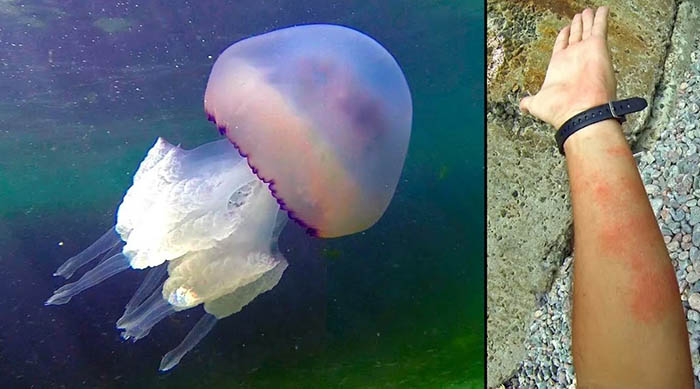Медузы в Азовском море какие есть, почему бывает много